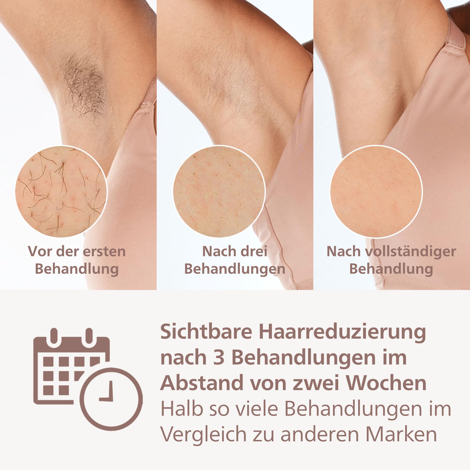 Philips Lumea IPL 8000 Haarentfernungsgerät - Laser-Alternative mit Korrekturtrimmer & 4 Aufsätzen für Körper, Gesicht, Bikinizone (BRI949/00)